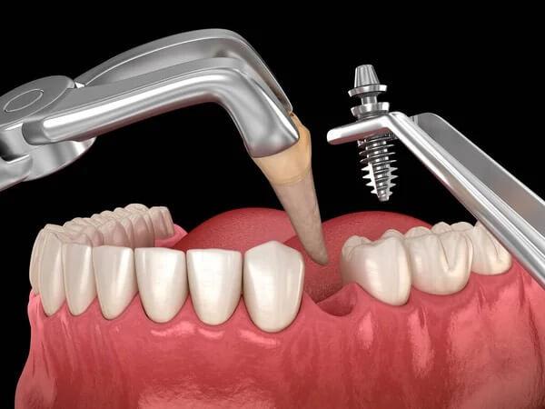Implantology