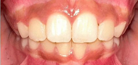 After Image
