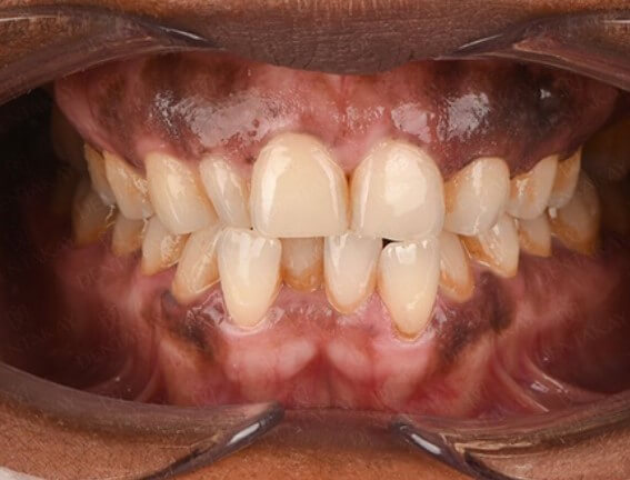 Before Image