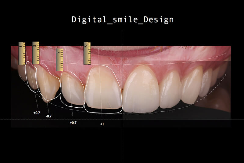 Teeth