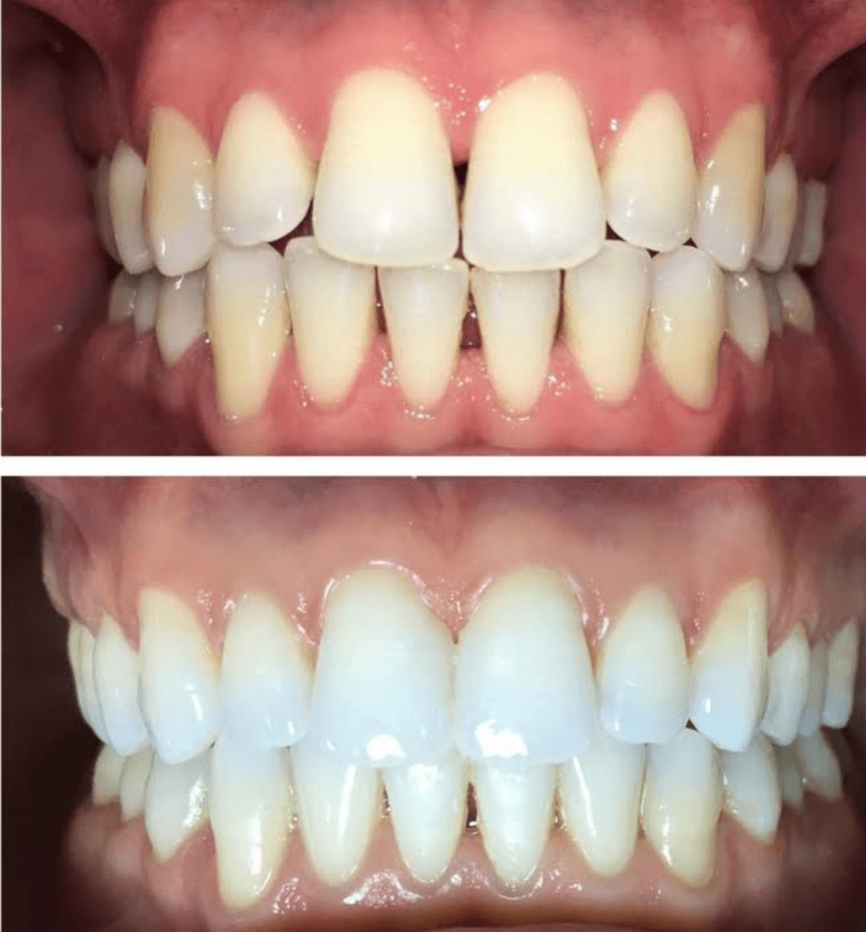Teeth